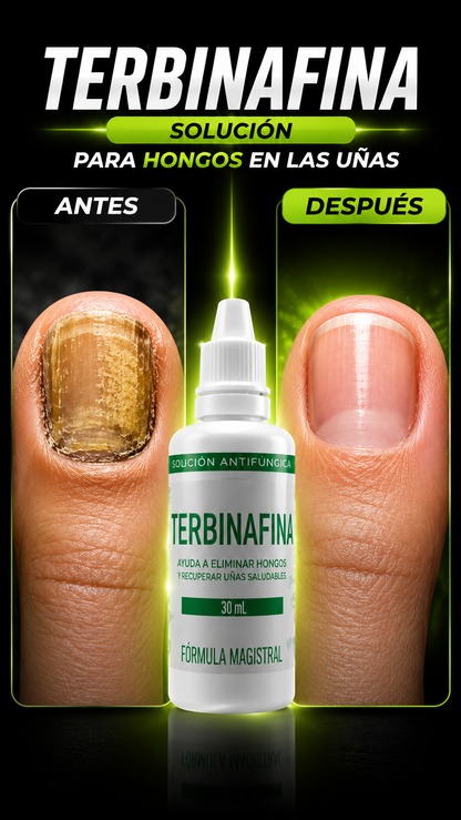 Terbinafina 8% Antihongos para Uñas